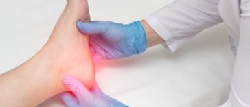 Óleos Essenciais para Esporão Ósseo