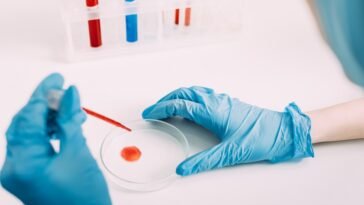 Óleos Essenciais para Toxicidade do Sangue