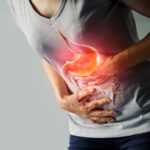 Óleos Essenciais para Úlcera Gástrica