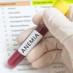 óleos essenciais para anemia