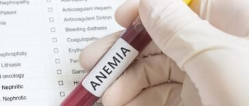 óleos essenciais para anemia