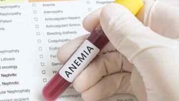 óleos essenciais para anemia