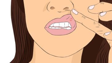 Óleos Essenciais para Afta
