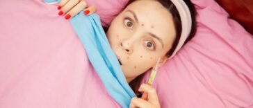 Óleos Essenciais para Catapora