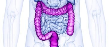 Óleos Essenciais para Diverticulite