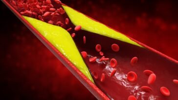 Óleos Essenciais para Aterosclerose