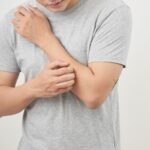 Óleos Essenciais para Coceira