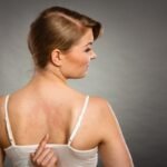 Óleos Essenciais para Urticária