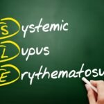 Óleos Essenciais para Lúpus