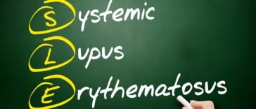 Óleos Essenciais para Lúpus