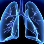 Óleos Essenciais para Pneumonia