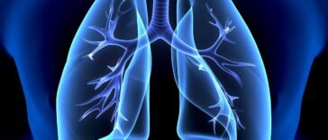 Óleos Essenciais para Pneumonia