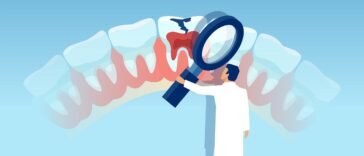 Óleos Essenciais para Cárie Dentária