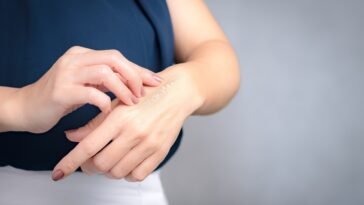 Óleos Essenciais para Cicatriz