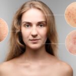 Óleos Essenciais para Manchas na Pele