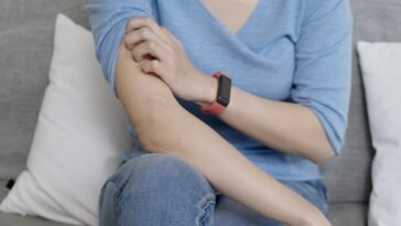 Óleos Essenciais para Dermatite
