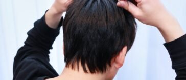 Óleos Essenciais para Dermatite Seborréica