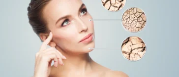 Hidratante para Pele Seca