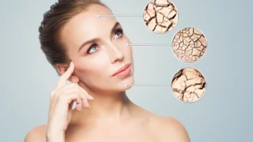 Hidratante para Pele Seca